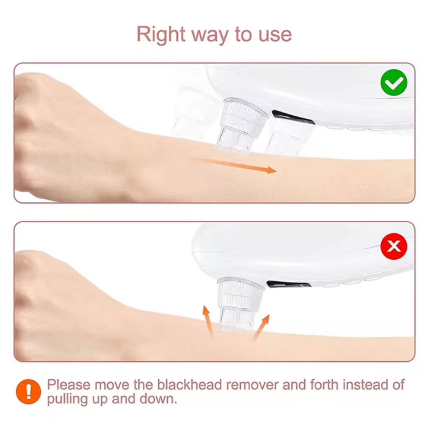 Black Head Remover